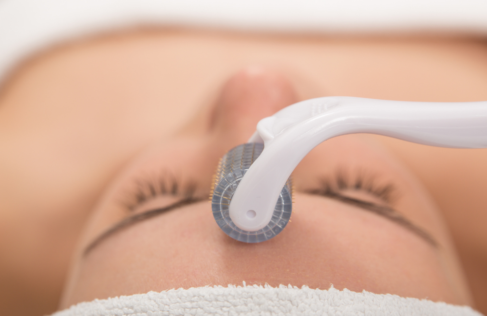 Microagulhamento Facial: O Segredo para uma Pele Renovada e Rejuvenescida