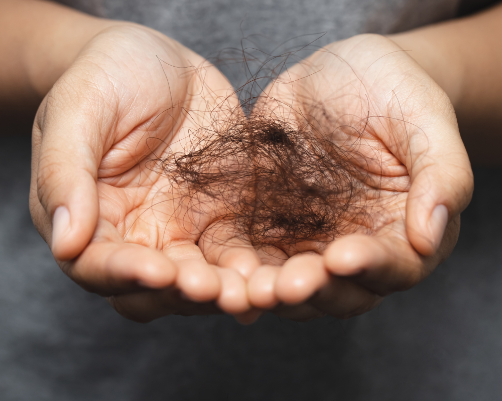 Queda de Cabelo no Verão: Por Que Aumenta e Como Tratar (Dicas Profissionais + Em Casa)